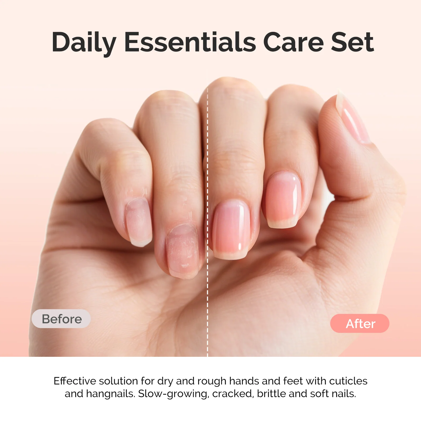 TPO-Free Cuticle Care Kit 25ml with Cuticle Oil and Remover