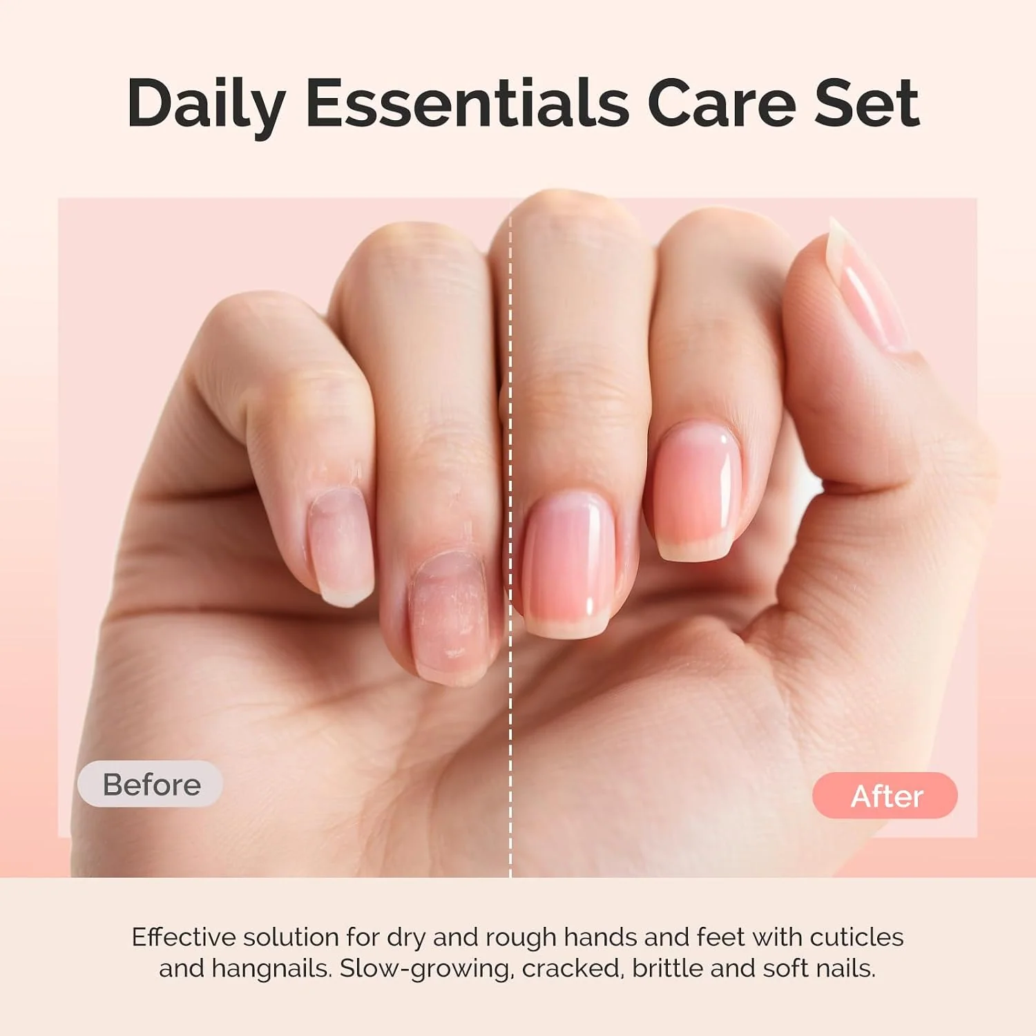 Cuticle Remover Kit with Nourishing Cuticle Oil and 7-in-1 Manicure Tools